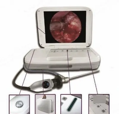 NovaStar, GL348, Portable Endoscope Camera, 15 Inch HD Medical Monitor, 35W LED Cold Light
