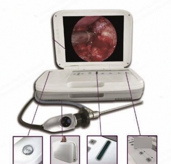 NovaStar, GL348, Portable Endoscope Camera, 15 Inch HD Medical Monitor, 35W LED Cold Light