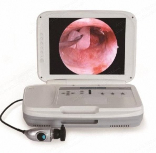 NovaStar, GL347, HD Portable Endoscope Camera, 15 Inch Monitor, 35W LED Cold Light