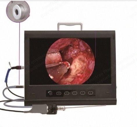 NovaStar, GL349, 1/2.8 Inch Sony CMOS HD Camera, 19 Inch HD Medical Monitor, Built-in 80W LED Cold Light